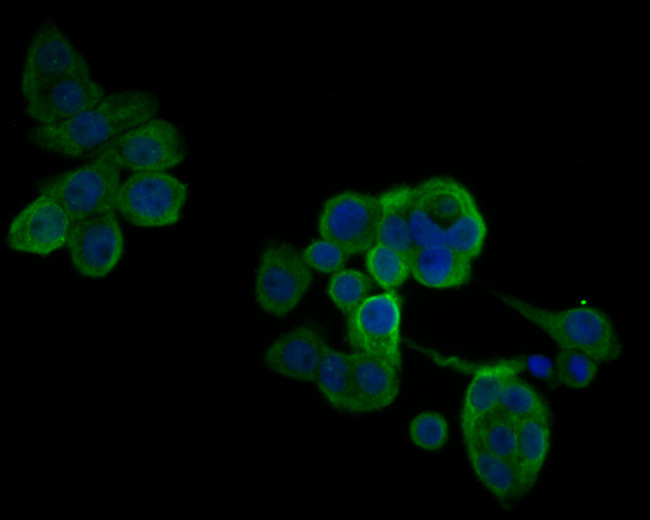 IL18BP Antibody in Immunocytochemistry (ICC/IF)