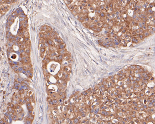 ENT1 Antibody in Immunohistochemistry (Paraffin) (IHC (P))