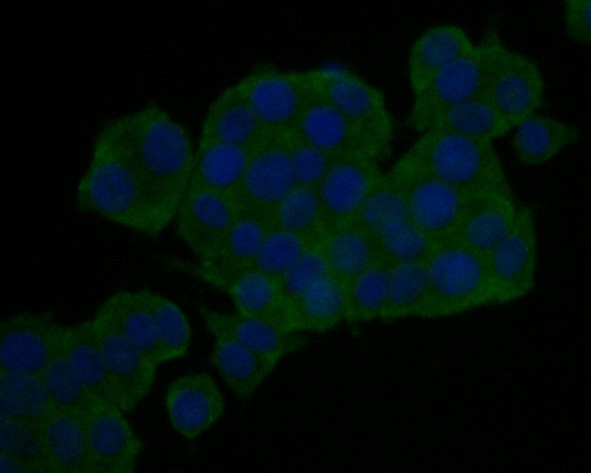 KIDINS220 Antibody in Immunocytochemistry (ICC/IF)