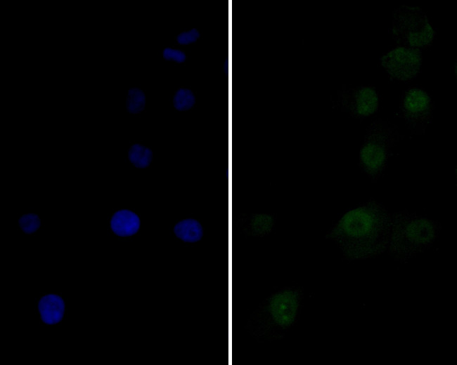 Ki-67 Antibody in Immunocytochemistry (ICC/IF)