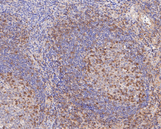 IFITM1 Antibody in Immunohistochemistry (Paraffin) (IHC (P))