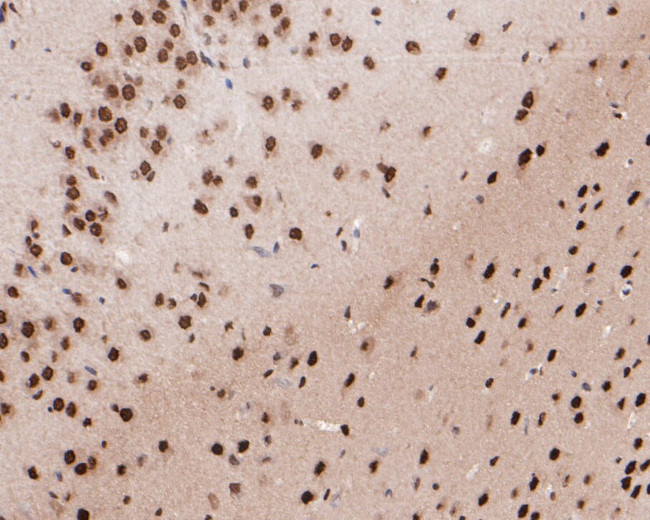 LIM1 Antibody in Immunohistochemistry (Paraffin) (IHC (P))