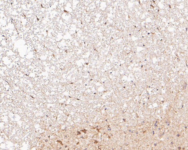P2X3 Antibody in Immunohistochemistry (Paraffin) (IHC (P))