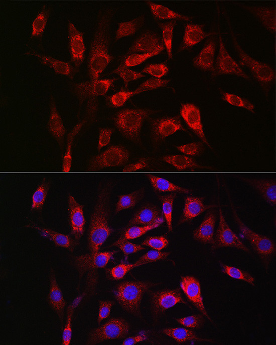 SOCS3 Antibody in Immunocytochemistry (ICC/IF)