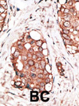 HPCAL1 Antibody in Immunohistochemistry (Paraffin) (IHC (P))