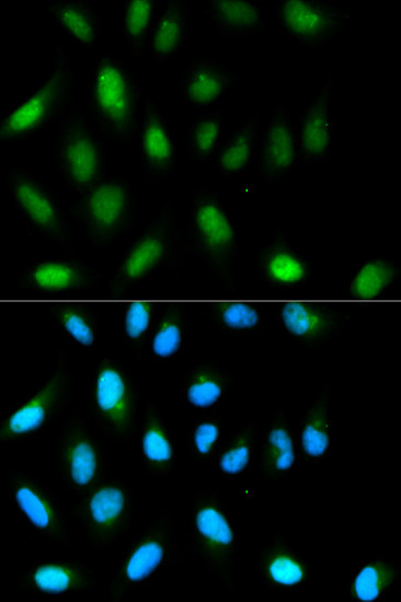 HP1 alpha Antibody in Immunocytochemistry (ICC/IF)