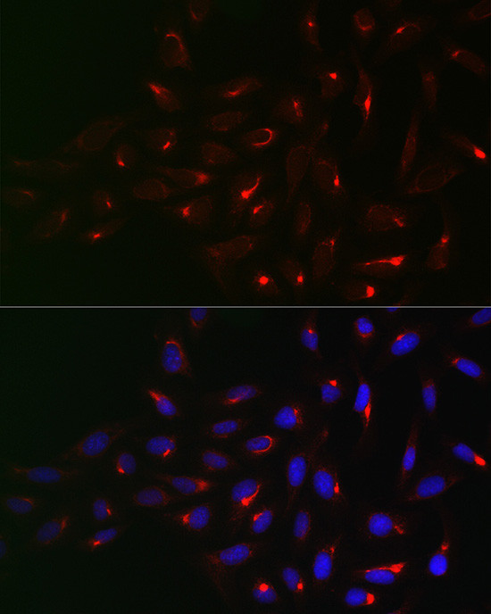 Vimentin Antibody in Immunocytochemistry (ICC/IF)