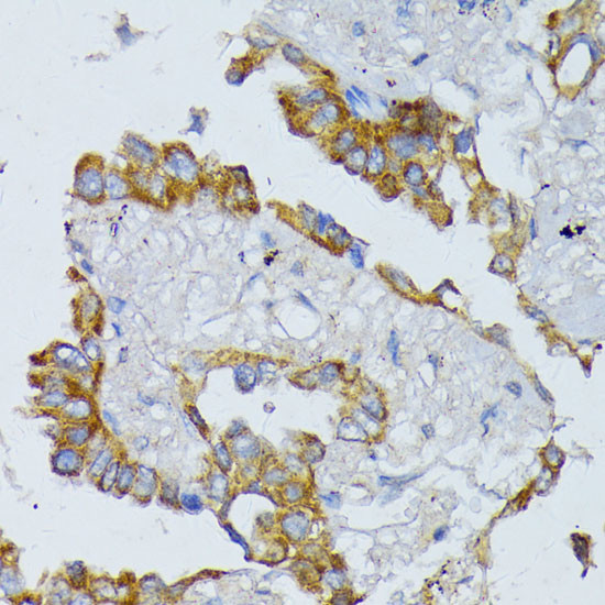 ACADL Antibody in Immunohistochemistry (Paraffin) (IHC (P))