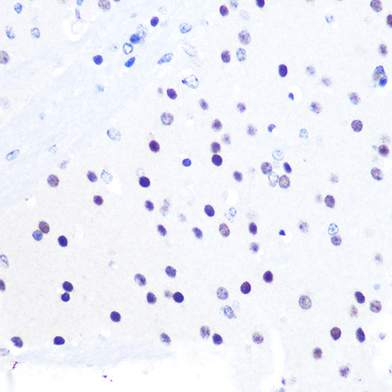 PEG3 Antibody in Immunohistochemistry (Paraffin) (IHC (P))