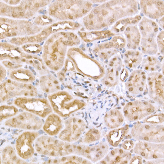 AMPK alpha-1,2 Antibody in Immunohistochemistry (Paraffin) (IHC (P))