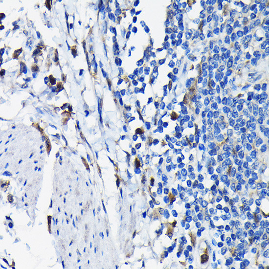 STK19 Antibody in Immunohistochemistry (Paraffin) (IHC (P))