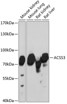 ACSS3 Antibody in Western Blot (WB)