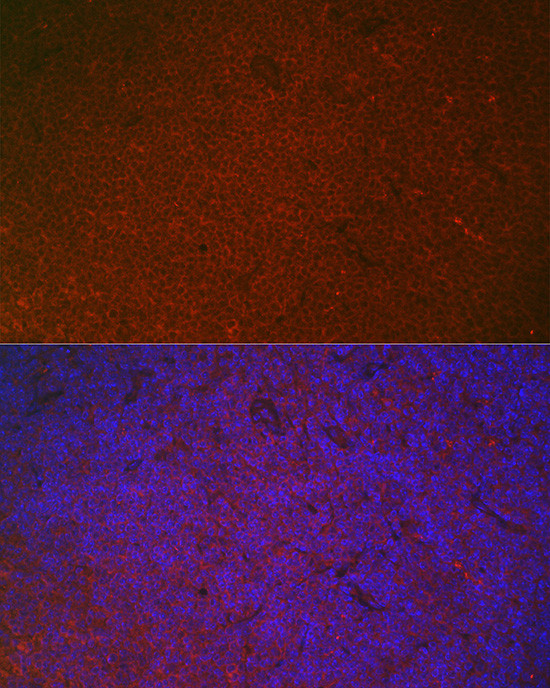 FCGR2A Antibody in Immunohistochemistry (Paraffin) (IHC (P))