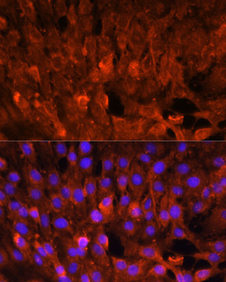 CIS Antibody in Immunocytochemistry (ICC/IF)