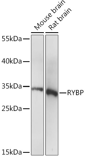 RYBP Antibody in Western Blot (WB)