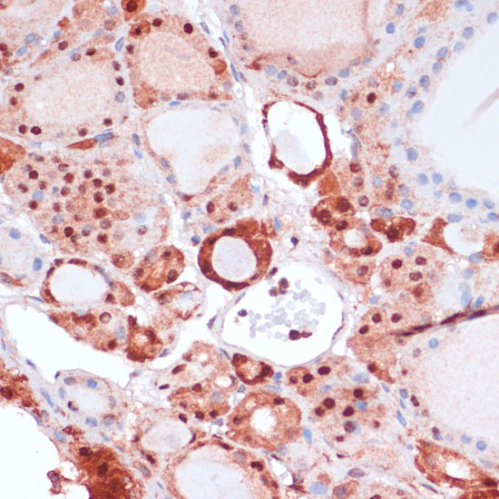 S100A5 Antibody in Immunohistochemistry (Paraffin) (IHC (P))