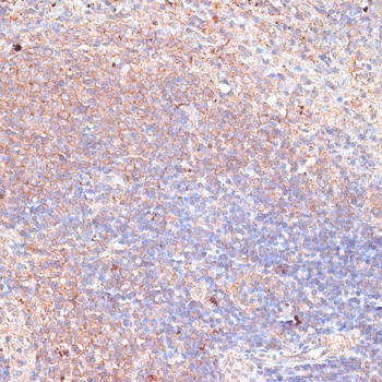 TMX Antibody in Immunohistochemistry (Paraffin) (IHC (P))