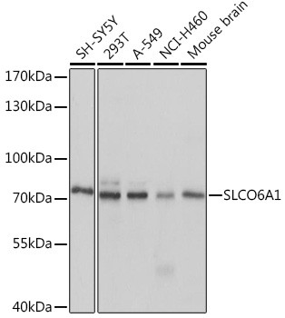 SLCO6A1 Antibody in Western Blot (WB)