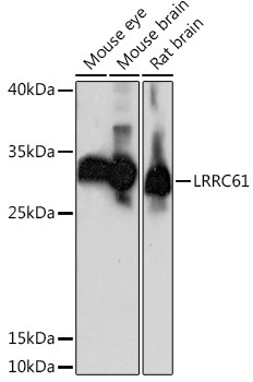 LRRC61 Antibody in Western Blot (WB)