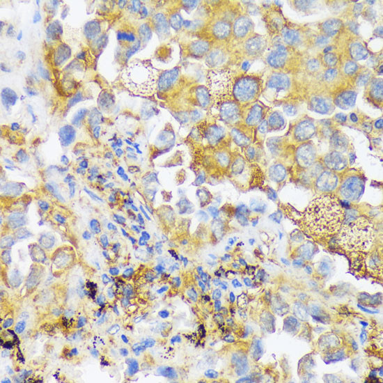 ZDHHC18 Antibody in Immunohistochemistry (Paraffin) (IHC (P))