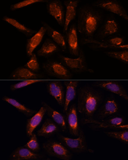 POLRMT Antibody in Immunocytochemistry (ICC/IF)