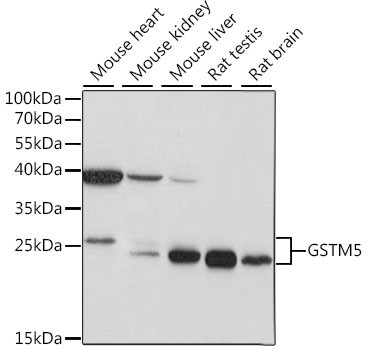 GSTM5 Antibody in Western Blot (WB)