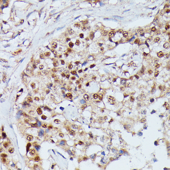 IGHMBP2 Antibody in Immunohistochemistry (Paraffin) (IHC (P))