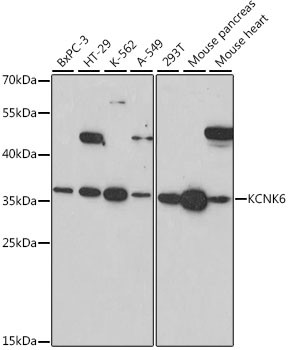 KCNK6 Antibody in Western Blot (WB)