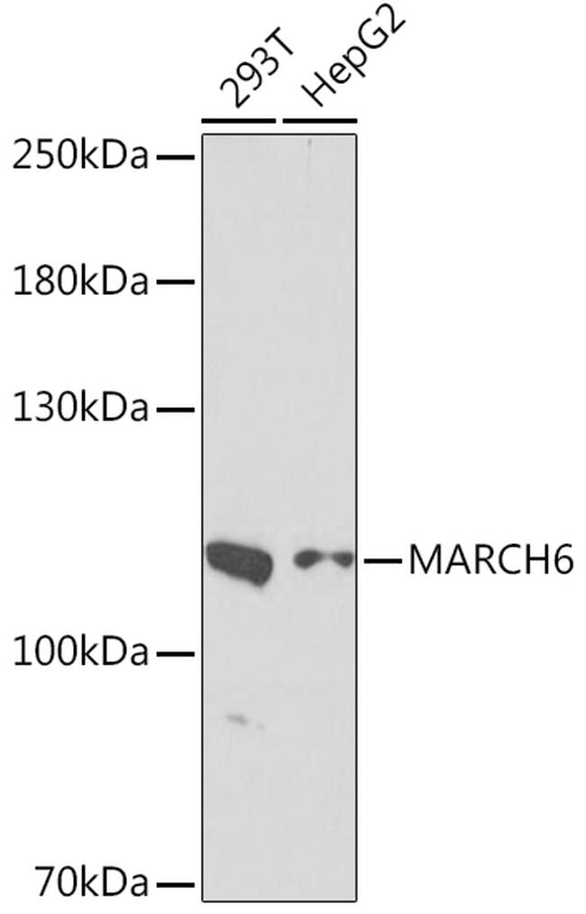 TEB4 Antibody in Western Blot (WB)