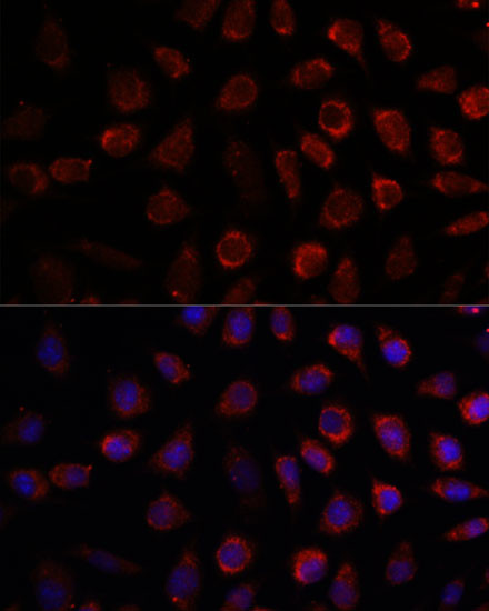 PDE11A Antibody in Immunocytochemistry (ICC/IF)