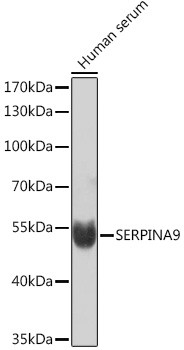 SERPINA9 Antibody in Western Blot (WB)