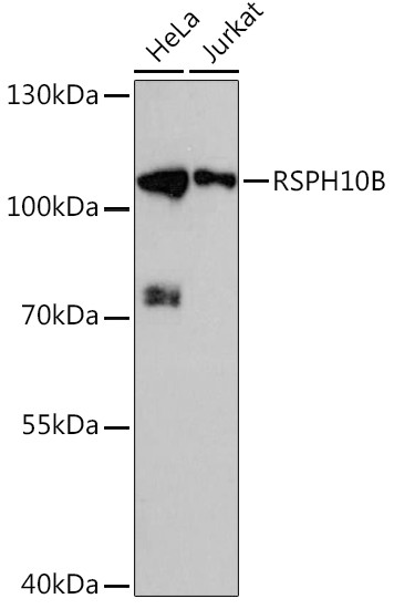 RSPH10B Antibody in Western Blot (WB)