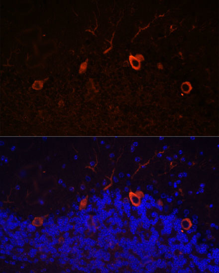 KAL1 Antibody in Immunohistochemistry (Paraffin) (IHC (P))