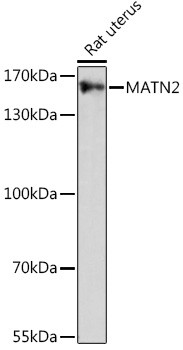 MATN2 Antibody in Western Blot (WB)