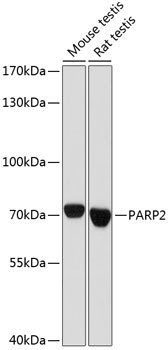 PARP2 Antibody in Western Blot (WB)