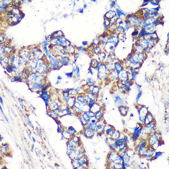 STARD3NL Antibody in Immunohistochemistry (Paraffin) (IHC (P))