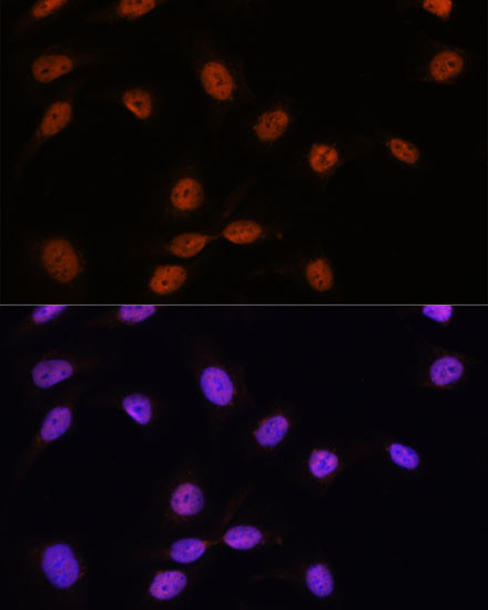 SRSF7 Antibody in Immunocytochemistry (ICC/IF)