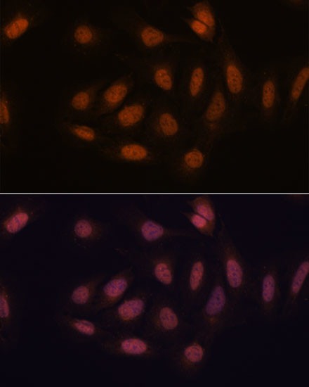 SNIP1 Antibody in Immunocytochemistry (ICC/IF)
