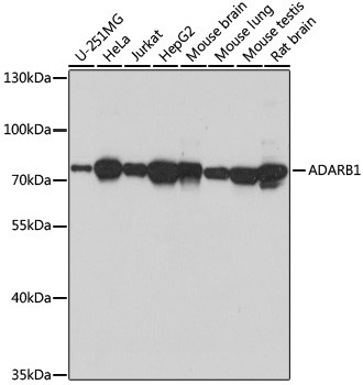 ADARB1 Antibody in Western Blot (WB)
