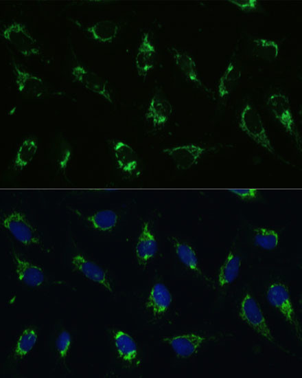 ATP5I Antibody in Immunocytochemistry (ICC/IF)