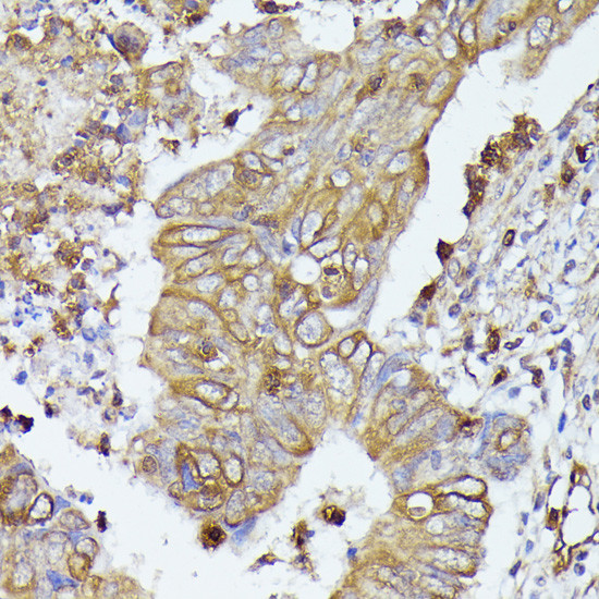 CD52 Antibody in Immunohistochemistry (Paraffin) (IHC (P))