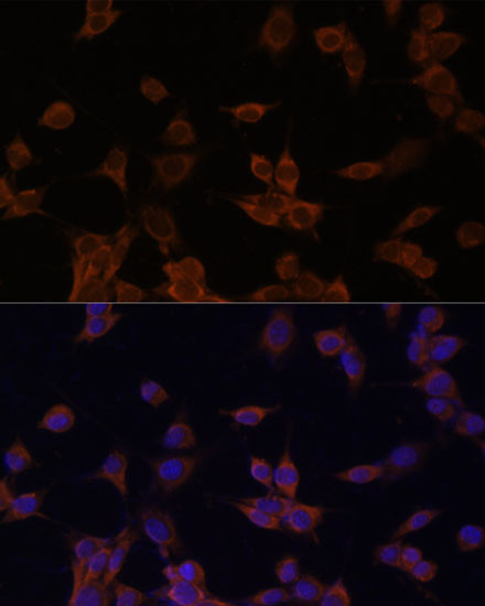 HMGCR Antibody in Immunocytochemistry (ICC/IF)