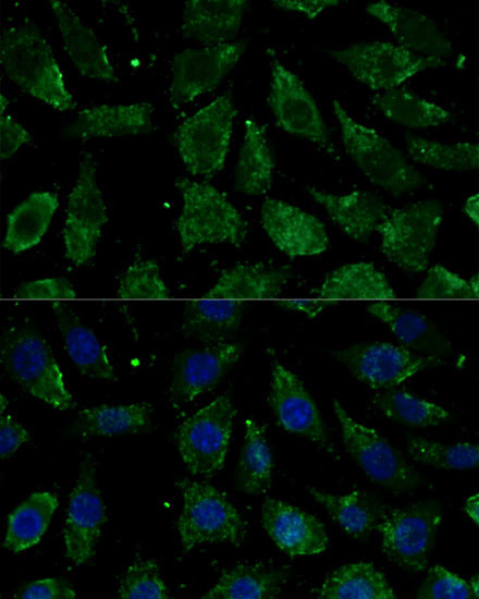 NDUFB1 Antibody in Immunocytochemistry (ICC/IF)