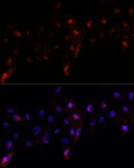 PEX10 Antibody in Immunocytochemistry (ICC/IF)