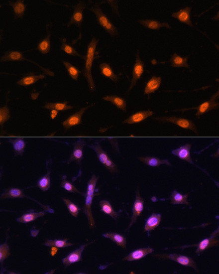 WT1 Antibody in Immunocytochemistry (ICC/IF)