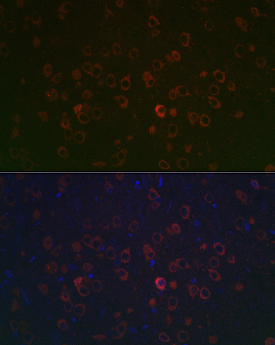 REEP2 Antibody in Immunohistochemistry (Paraffin) (IHC (P))