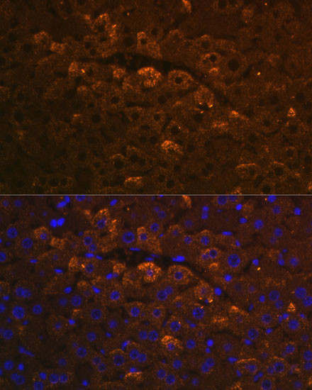 UGT1A6 Antibody in Immunohistochemistry (Paraffin) (IHC (P))
