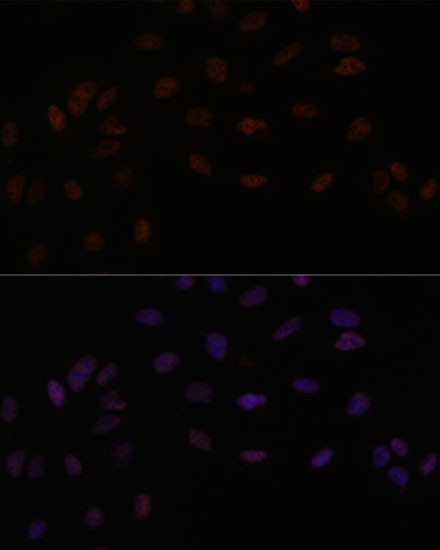 SMEK2 Antibody in Immunocytochemistry (ICC/IF)