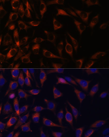 WFDC1 Antibody in Immunocytochemistry (ICC/IF)