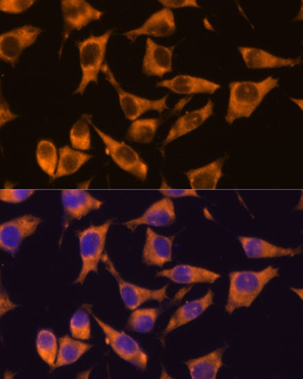 CaMKV Antibody in Immunocytochemistry (ICC/IF)